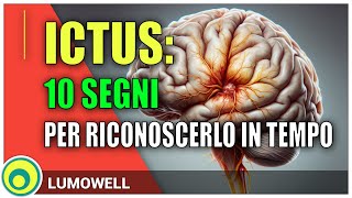 I Sintomi di un Ictus Cerebrale [upl. by Luann]