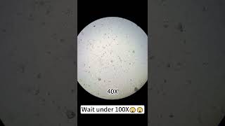 Coconut water at 400X is just awesomeunderthemicroscope [upl. by Auqinehs]