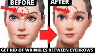 EASY STEP TO GET RID OF WRINKLES BETWEEN EYEBROWS  GET RID OF WRINKLES BETWEEN FROWN LINES [upl. by Lloyd]