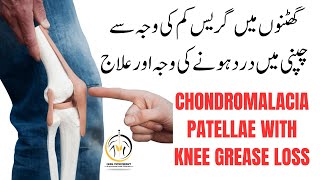 Best Exercise for Chondromalacia Patella  Jumpers Knee  Runners Knee Pain  Patellar Tendinitis [upl. by Gilletta]