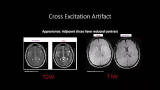 MRI Artifacts and their Compensation [upl. by Adnorrehs]