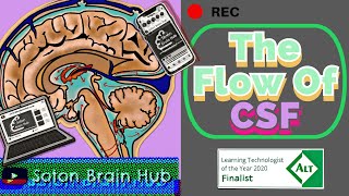 The Flow of CSF and Pathologies [upl. by Tor884]