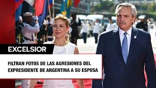 Filtran FOTOS de las agresiones del expresidente de Argentina a su esposa [upl. by Mariano613]