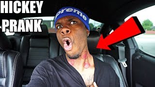 HICKEY PRANK ON GIRLFRIEND UNEXPECTED REACTION [upl. by Iahc]