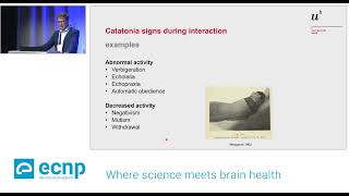 Catatonia aetiology presentation assessment and treatment 2392024 [upl. by Iznekcam]