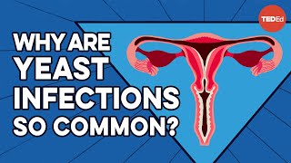 What causes yeast infections and how do you get rid of them  Liesbeth Demuyser [upl. by Anaylil747]