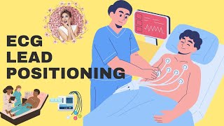 Mastering ECG Lead Placement [upl. by Parker577]