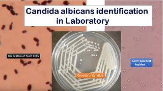 Candida growth on SDA Gram stain and Germ tube test Positive [upl. by Siouxie]