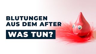 BLUTUNG aus dem AFTER Dr Eduard Karsten klärt auf [upl. by Eeb952]