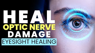 Eyesight Healing Frequency  Heal Optic Nerve Damage  Get Relief from Eye Strain Fast  528Hz Music [upl. by Lankton]