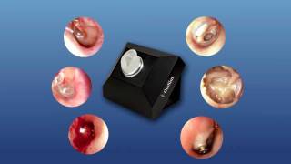 OtoSim™ Otoscopy Training amp Simulation  Intro [upl. by Nivag]