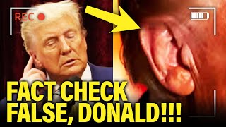 Trump SO CALLED EAR INJURY Claim BACKFIRES in His FACE [upl. by Mcnair]