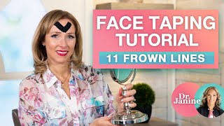 Face Taping Tutorial for 11 Frown Lines  Dr J9 Live [upl. by Yanttirb320]