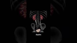 radiology التشخيصالطبي medicalconsultation radiologylife duplex kidney double ureter [upl. by Chaffinch]