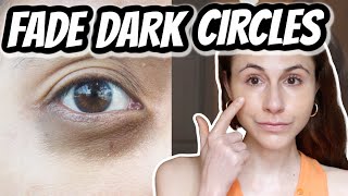 HOW TO GET RID OF DARK CIRCLES PERMANENTLY 👀 Fast and Effective [upl. by Agrippina]