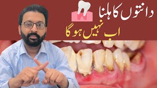 LOOSE TEETH Treatment Home Remedies [upl. by Ecnarrot538]