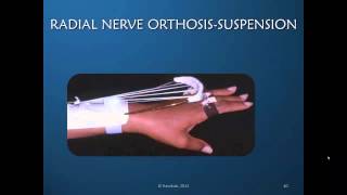 Radial Nerve Rehabilitation amp Orthotic Intervention Preview [upl. by Sessilu487]