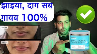 Hyaluronic water gelHyaluronic water gel review Hyaluronic water gel kaise use kare parasbynuskhe [upl. by Aiva470]