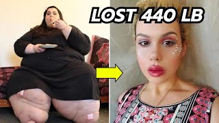 20 People Who Lost Weight in Incredible Ways [upl. by Fidelis255]