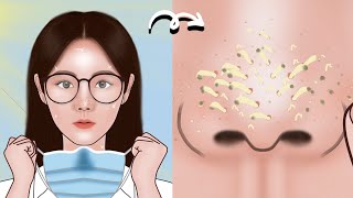 Satisfying Full Blackhead Treatment At Home ASMR skincare animation丨Mengs Stop Motion [upl. by Kimball]