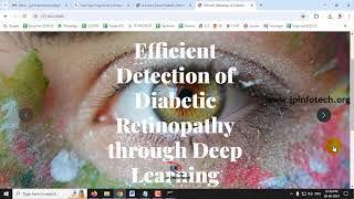 Efficient Detection of Diabetic Retinopathy through Deep Learning  Python IEEE Project 2024 [upl. by Nnazil]