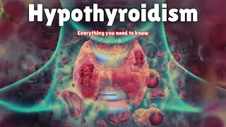 Hypothyroidism  Symptoms Causes Treatment amp Medication [upl. by Clarinda]