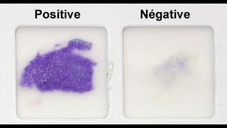 Oxidase Test Practical Tutorial [upl. by Sakiv]