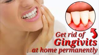 How to get rid of gingivitis quickly by natural remedies tips [upl. by Icart]