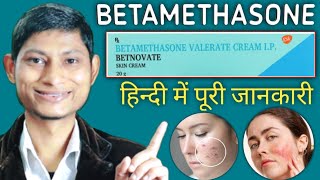 betamethasone valerate cream ip  betamethasone dipropionate cream  betnovate cream ke fayde [upl. by Haroun]