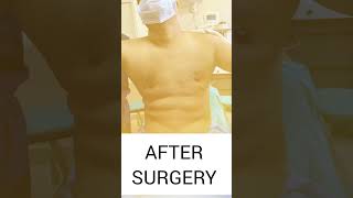 Gynecomastia Before and After Results  Rejuvena Cosmo Care in Jaipur  Dr Deepesh Goyal [upl. by Inalawi644]