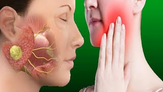 Salivary Gland Infection Causes And Treatment [upl. by Deny]