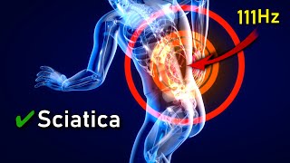 ITS HERE ❯❯❯ The Sciatica quotMIRACLEquot Pain Treatment Frequency Immediate Relief 111Hz [upl. by Mota]