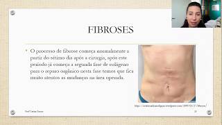 Revisão Pós Operatorio Fibrose Complicações Microcorrentes  Parte 1 [upl. by Eirene829]