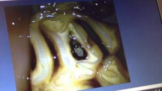 Oroscopic examination of the molar arcades teeth in a horse occlusal surface [upl. by Amees759]