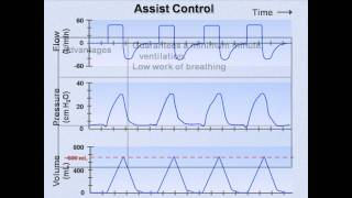 Ventilator Modes Mechanical Ventilation  Lecture 7 [upl. by Peria920]