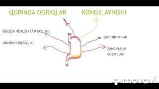 Gastrit Kasaligini kelib chiqishi Belgilari va Davolash [upl. by Annawoj]