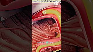 Mechanical Thrombectomy in stroke medicine anatomy science health stroke TheLearnmedicineshow [upl. by Neelhtac]