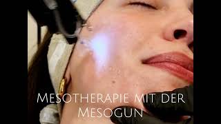 Mesotherapie mit der Mesogun im Urban Spa Hamburg [upl. by Rebmak608]