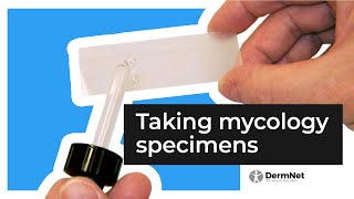 Fungal infections taking a mycology sample [upl. by Delwin]