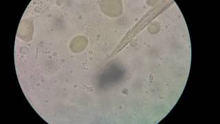 Filariform larva of Hookworms [upl. by Ocsinarf]