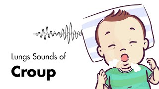 Sounds of Croup Laryngotracheitis  Lung Sounds  MEDZCOOL [upl. by Tdnaltroc929]