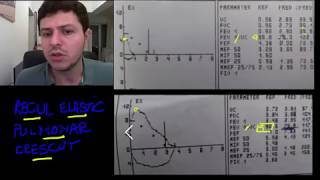 Spirometrie 8  recul elastic pulmonar crescut [upl. by Nnalatsyrc2]