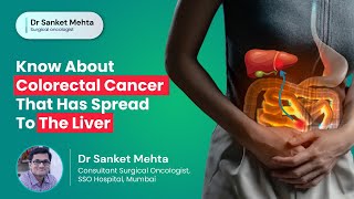 Know About Colorectal Cancer That Has Spread to the Liver  Colorectal Liver Metastasis  Dr Sanket [upl. by Anytsirhc103]