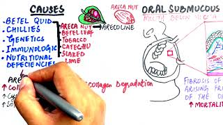 Oral Submucous Fibrosis  Causes Histopathology Epidemiology amp Treatment [upl. by Walke457]