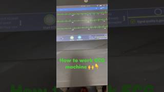 How to use ECG machine shorts music song SheetalSaini1999 [upl. by Hayimas]