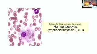 Hemophagocytic Lymphohistiocytosis HLH – Dr Maher Aljhohani September 1516 2023 [upl. by Ennayelsel]