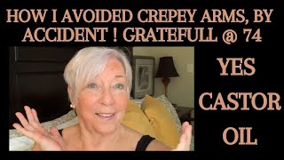 HOW I AVOIDED CREPEY ARMS WITH CASTOR OIL BY ACCIDENT [upl. by Jc]