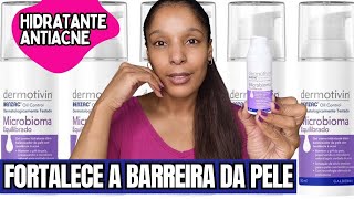 RESENHA GEL CREME HIDRATANTE DERMOTIVIM BENZAC OIL CONTROL MICROBIOMA EQUILIBRADO ACNE PROBIÓTICOS [upl. by Martens111]