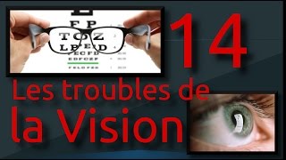 14  Les troubles de la vision [upl. by Dylana]