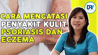 Cara atasi Eksim Eczema dan Psoriasis [upl. by Sorodoeht]